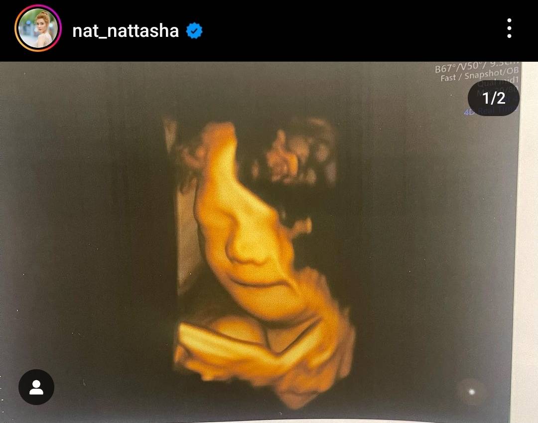 เกิดวันเดียวกันหมดเลย แนท ณัฐชา เผยวันคลอดลูกคนที่ 2