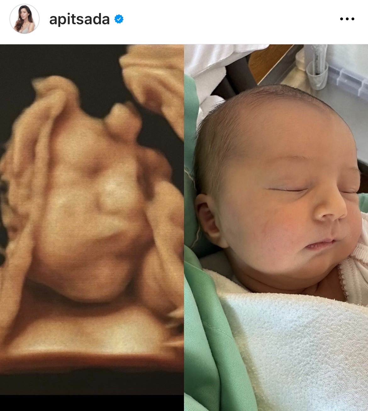 ไอซ์ อภิษฎา อวดเบบี๋ เลอา พูดได้คำเดียว น่ารักมาก!! ไอซ์ อภิษฎา อวดเบบี๋ เลอา พูดได้คำเดียว น่ารักมาก!!