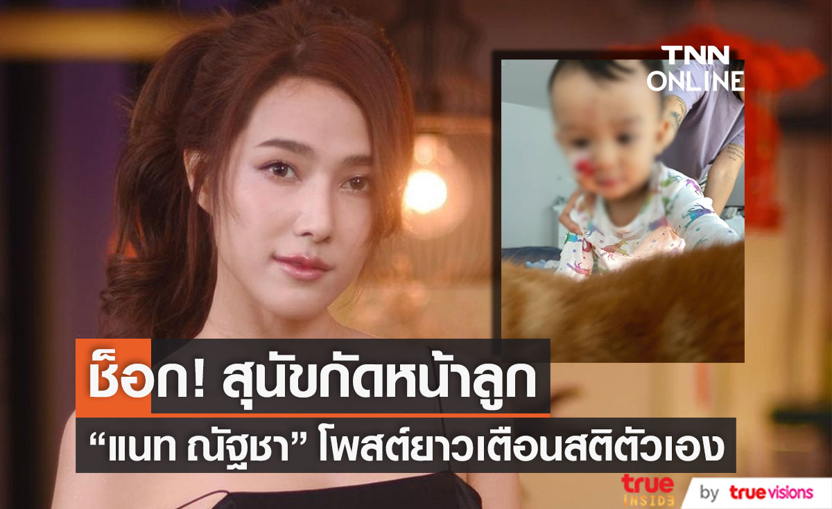 สุดช็อก! "แนท ณัฐชา" เล่าเหตุการณ์สุนัขกัดหน้าลูกชาย 