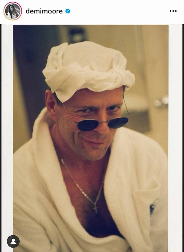 พักงานบันเทิง!! ‘บรูซ วิลลิส’ ตรวจพบภาวะบกพร่องทางการสื่อความหรือ Aphasia