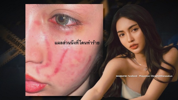 “โนอา” มอบหลักฐานเพิ่มเติมให้ตำรวจ  (มีคลิป)