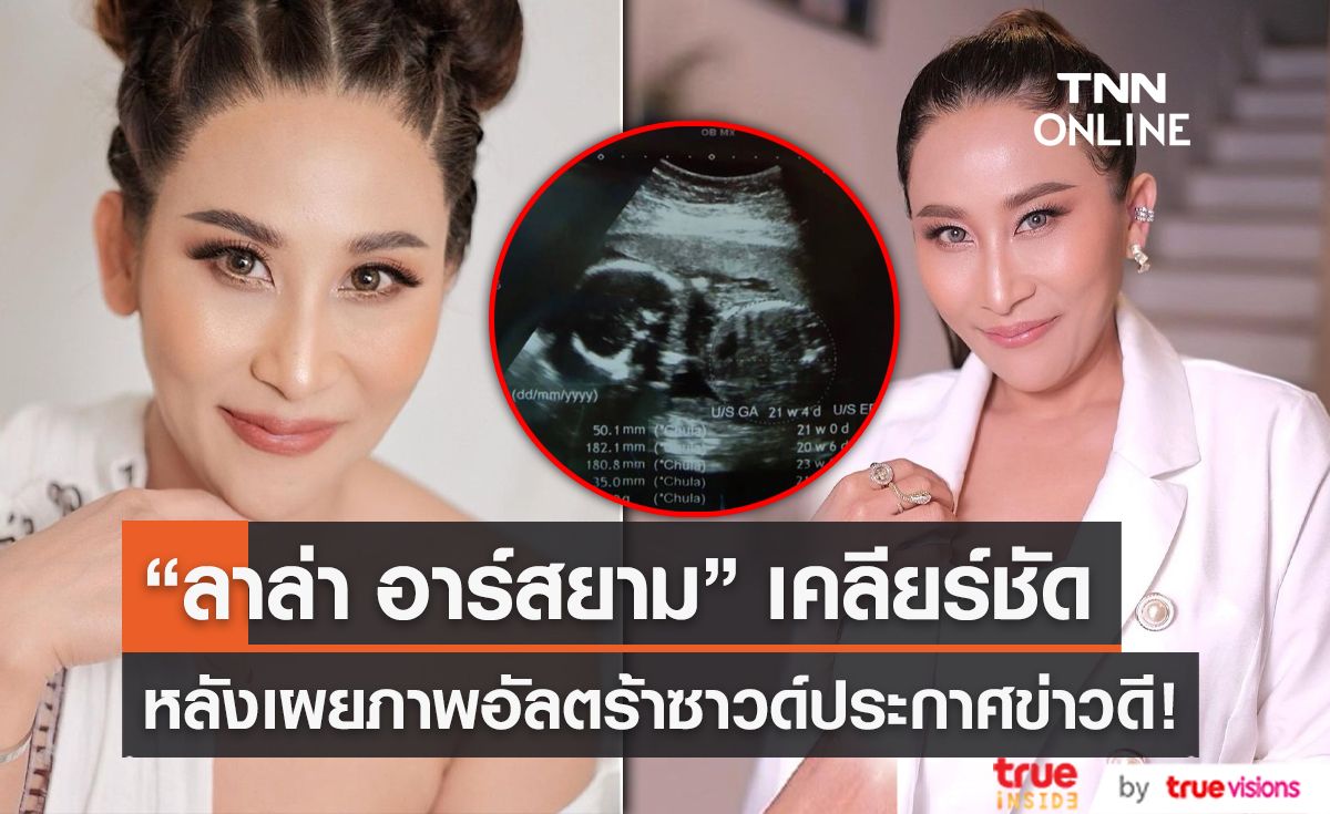 “ลาล่า อาร์สยาม” เคลียร์ชัด ภาพอัลตร้าซาวด์เป็นข่าวดีของน้อง (มีคลิป) 
