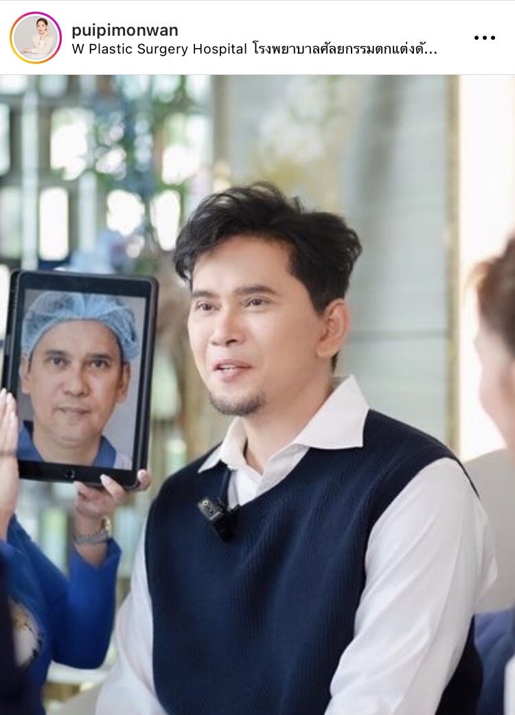 หล่อสมใจ! เปิดภาพ แมว จิรศักดิ์ หลังทำศัลยกรรม 20 วัน ลั่นนี่น้าแมวไม่ใช่ณเดชน์นะ 