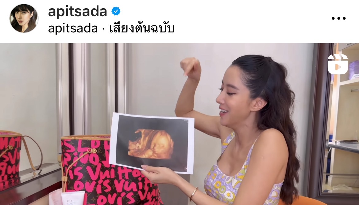 คุณแม่สายแซ่บ!! ไอซ์ อภิษฎา อวดครรภ์ 8 เดือน คุณแม่สายแซ่บ!! ไอซ์ อภิษฎา อวดครรภ์ 8 เดือน
