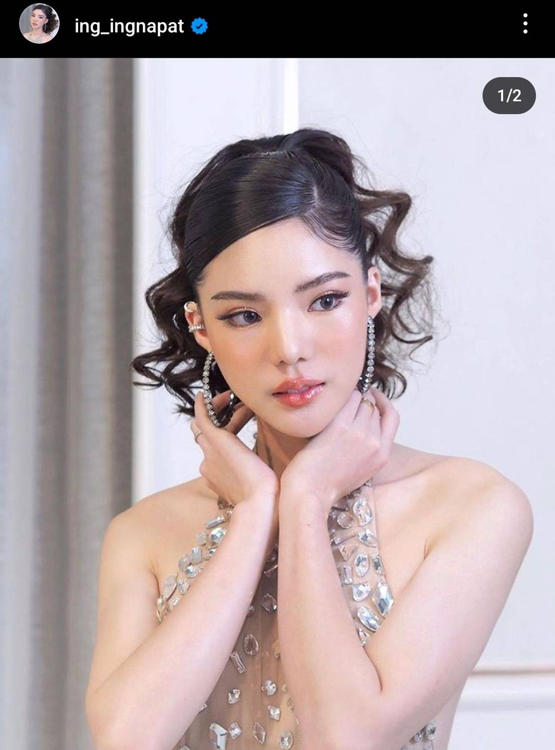 แฟนคลับห่วง อิงอิง อิงณภัสร์ ข้อมือหักหลังประสบอุบัติเหตุรถยนต์ เพราะโรคประจำตัวกำเริบ