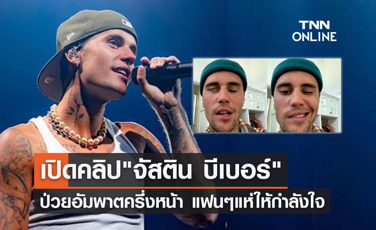 จัสติน บีเบอร์ ป่วยอัมพาตครึ่งหน้า! แฟนๆทั่วโลกให้กำลังใจเต็มไอจี