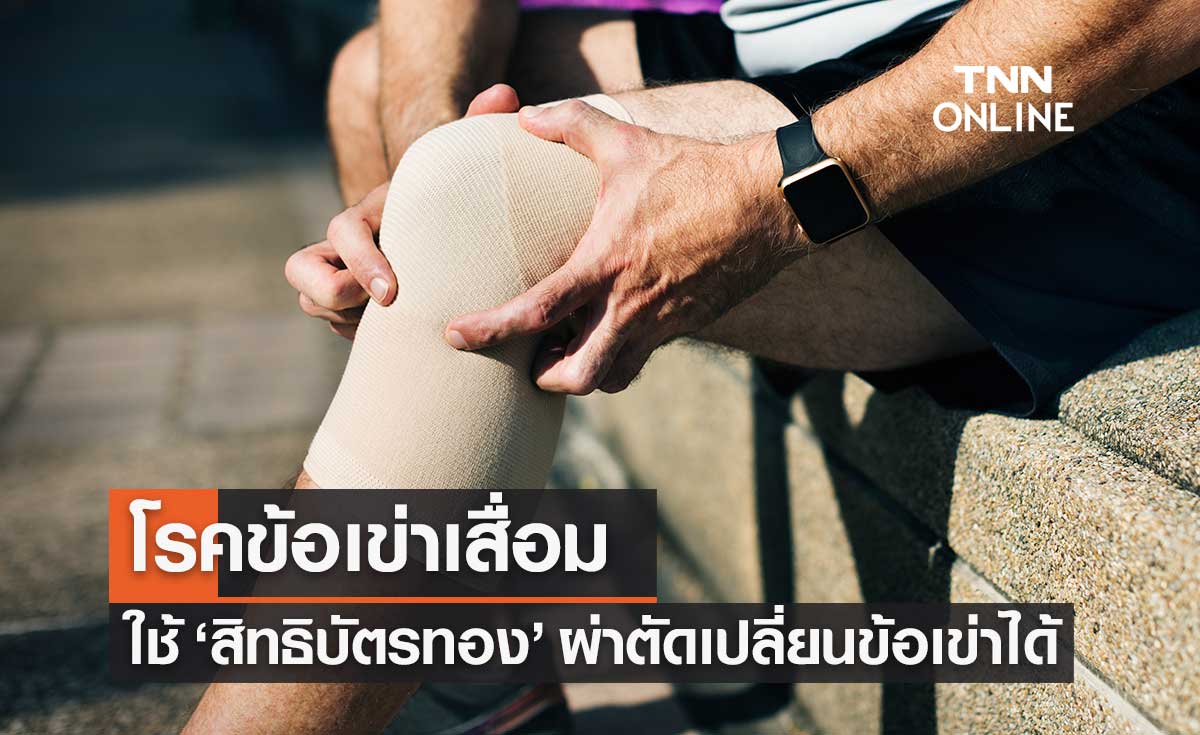 "โรคข้อเข่าเสื่อม" ใช้สิทธิบัตรทอง 30 บาท ผ่าตัดเปลี่ยนข้อเข่าเทียมได้แล้ว