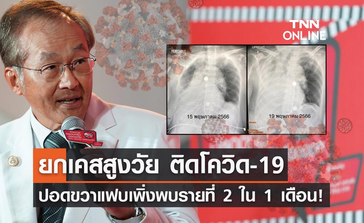 "หมอมนูญ" ยกเคสผู้ป่วยโควิด ปอดข้างขวาแฟบเพิ่งเห็นเป็นรายที่ 2 ใน 1 เดือน!