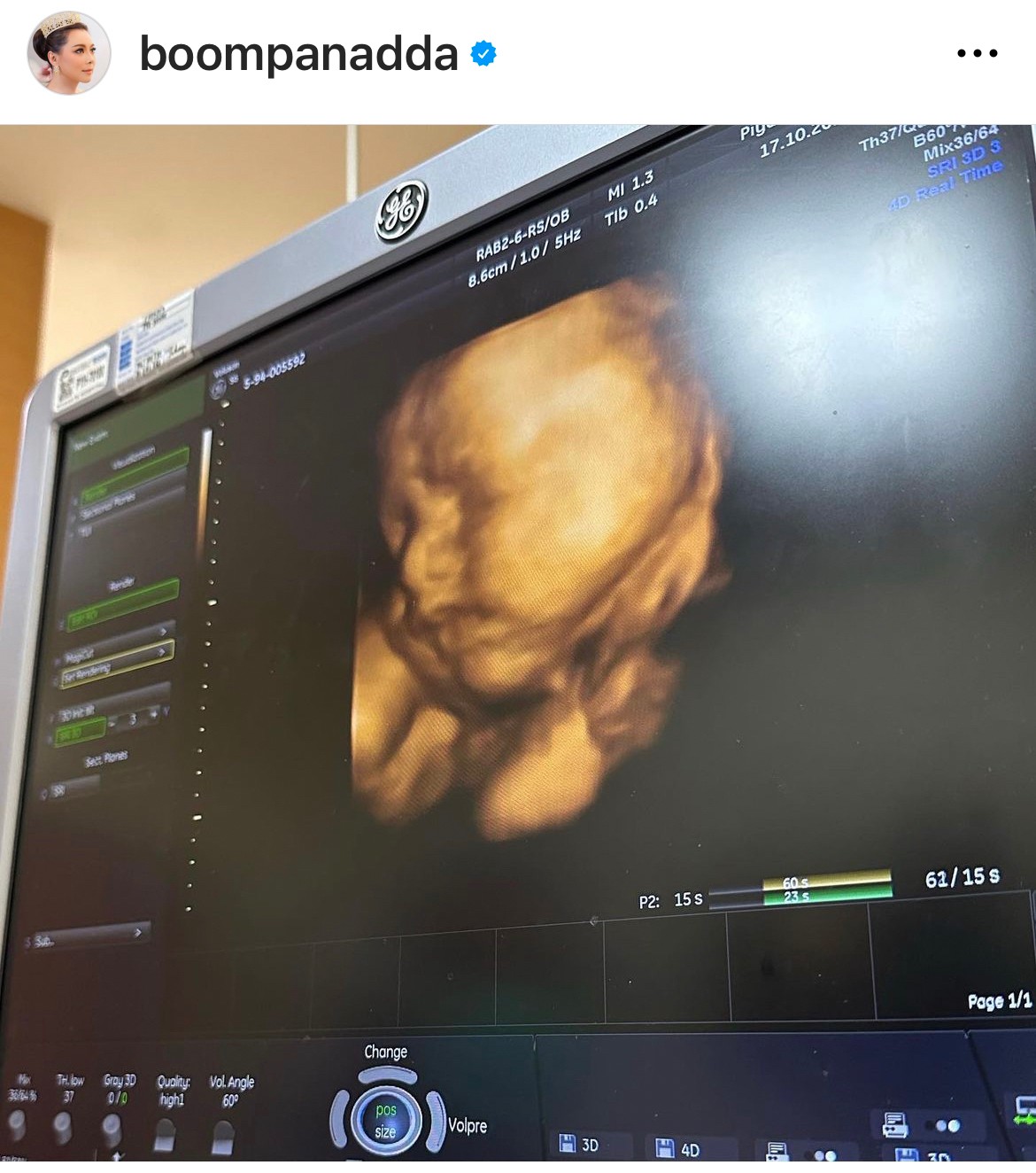 เปิดภาพแรกลูกชาย บุ๋ม ปนัดดา พร้อมหน้าคุณพ่อ ก็อต อธิป เปิดภาพแรกลูกชาย บุ๋ม ปนัดดา พร้อมหน้าคุณพ่อ ก็อต อธิป