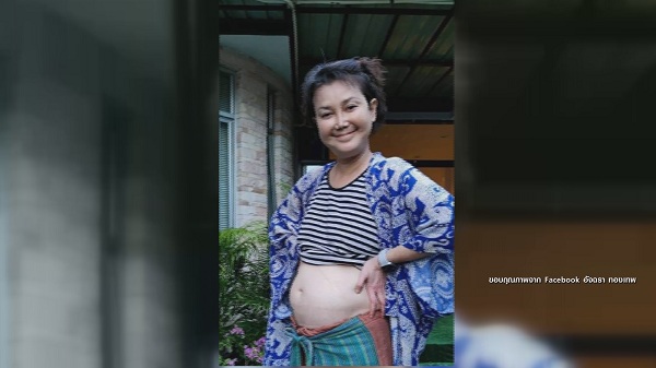 “เอ๋ อัจฉรา ทองเทพ เผยภาพใบหน้าและพุงที่บวม  (มีคลิป)