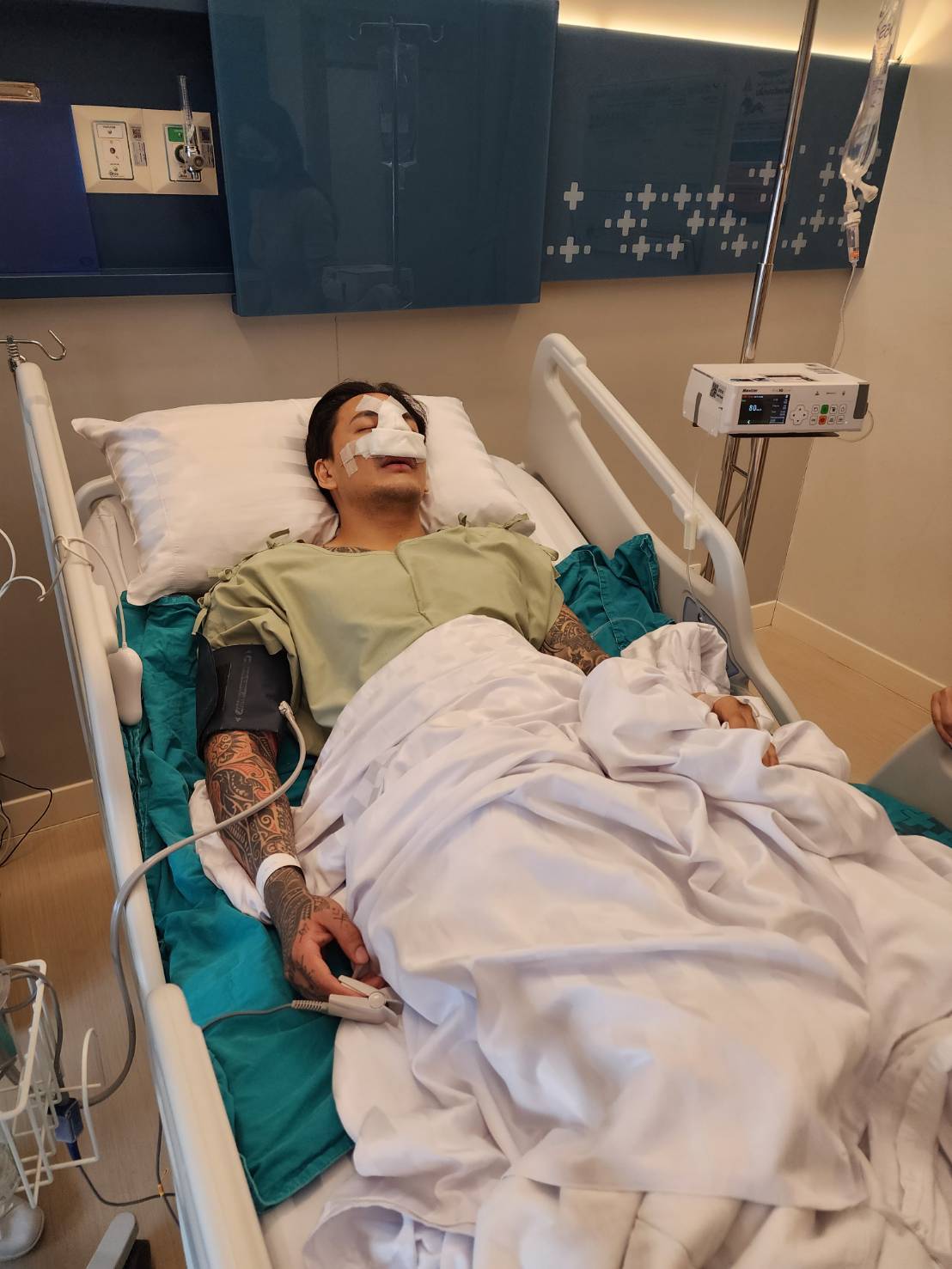 แทค ภรัณยู ออกจากห้องผ่าตัดแล้ว หลังถูกต่อยจมูกหัก แทค ภรัณยู ออกจากห้องผ่าตัดแล้ว หลังถูกต่อยจมูกหัก