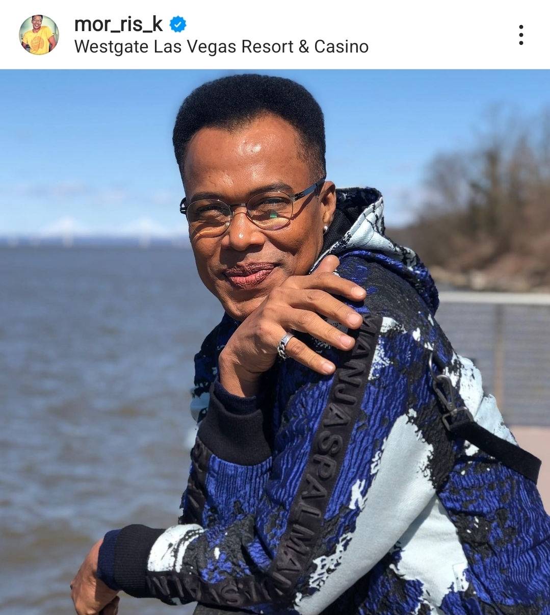 จบปัญหา มอริส เค ผ่าตัดเอ็นข้อมือ หลังทรมานมาหลายปี จบปัญหา มอริส เค ผ่าตัดเอ็นข้อมือ หลังทรมานมาหลายปี