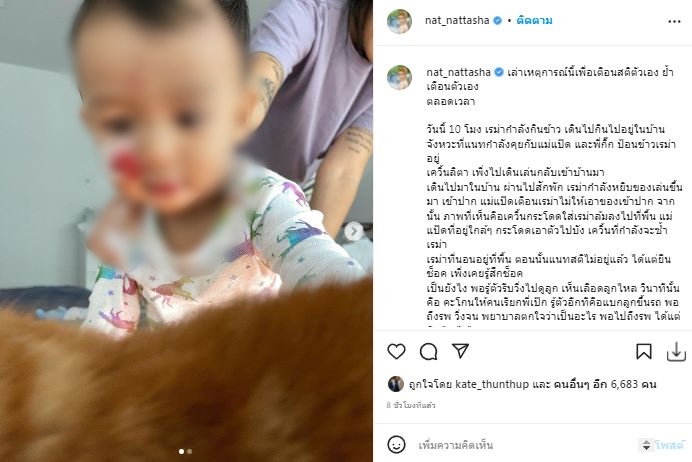 สุดช็อก! แนท ณัฐชา เล่าเหตุการณ์สุนัขกัดหน้าลูกชาย 
