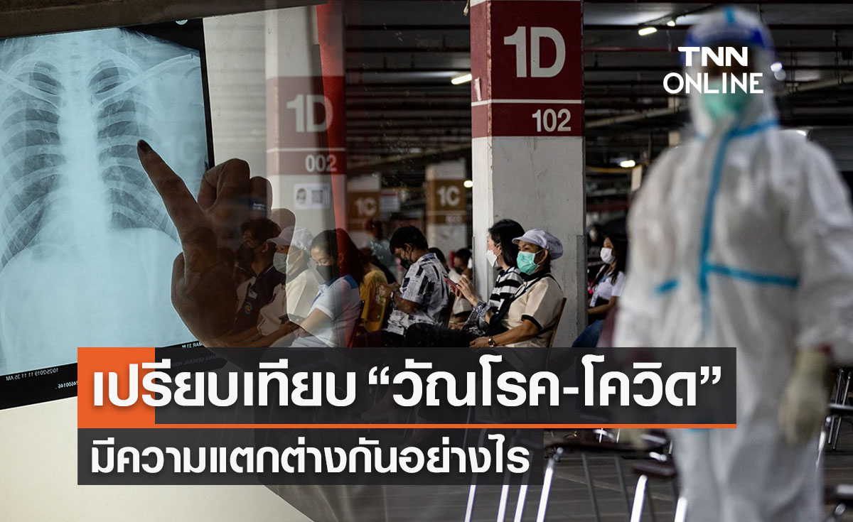 เปรียบเทียบ “วัณโรค-โควิด” มีความแตกต่างกันอย่างไร 