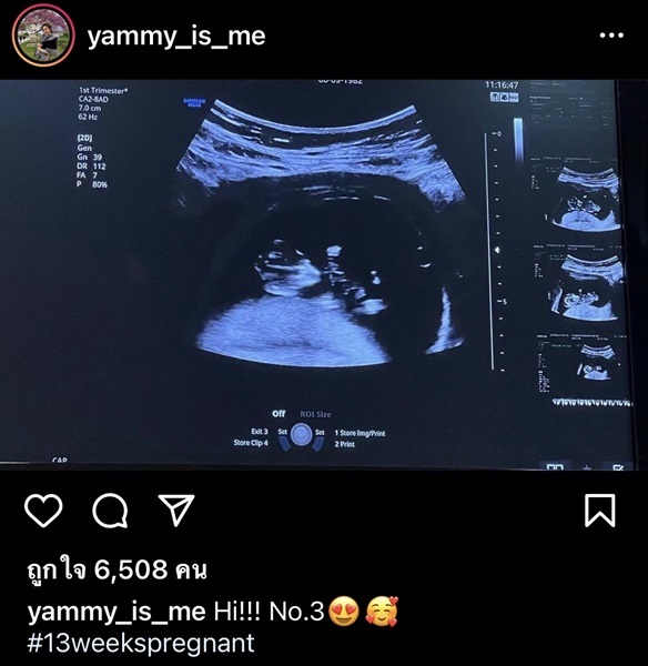 แยม ธมลพรรณ์ ประกาศข่าวดีกำลังตั้งครรภ์ทายาทคนที่ 3 แยม ธมลพรรณ์ ประกาศข่าวดีกำลังตั้งครรภ์ทายาทคนที่ 3