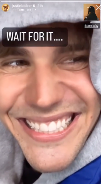 ดีขึ้นมาก!! 'จัสติน บีเบอร์' ยิ้มกว้างอัปเดตอาการอัมพาตใบหน้าครึ่งซีก ดีขึ้นมาก!! 'จัสติน บีเบอร์' ยิ้มกว้างอัปเดตอาการอัมพาตใบหน้าครึ่งซีก