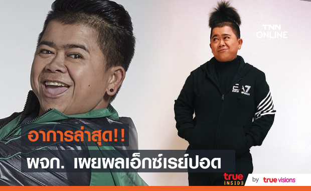 โก๊ะตี๋ อาการล่าสุด!!  รอผลเอ็กซ์เรย์ปอด