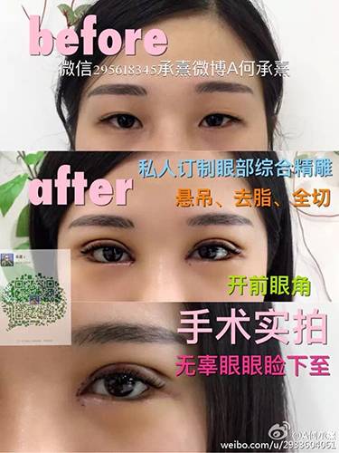 อยากเหมือนต้องได้เหมือน! สาวจีนทำหน้านาน 8 ปีจนกลายเป็น ฟ่านปิงปิง สอง อยากเหมือนต้องได้เหมือน! สาวจีนทำหน้านาน 8 ปีจนกลายเป็น ฟ่านปิงปิง สอง