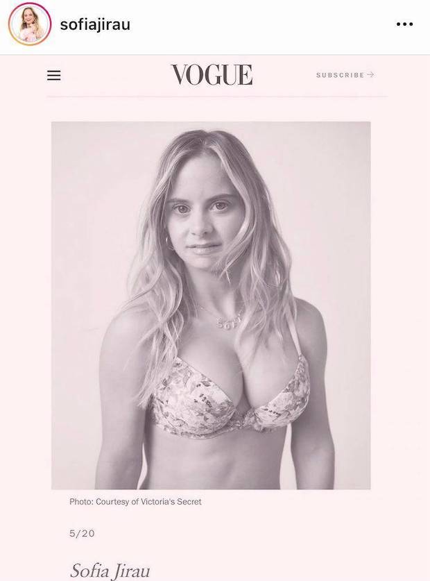 ครั้งแรกของแบรนด์!! Victoria’s Secret เปิดตัวนางแบบดาวน์ซินโดรมคนแรก ครั้งแรกของแบรนด์!! Victoria’s Secret เปิดตัวนางแบบดาวน์ซินโดรมคนแรก