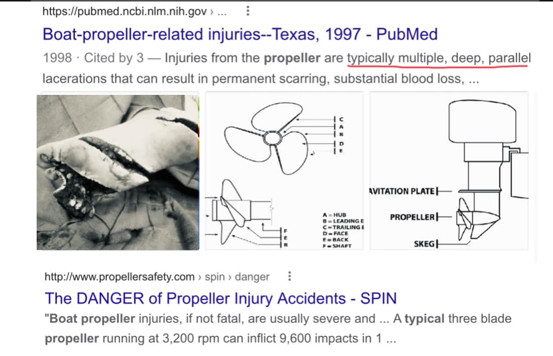 ไขข้อสงสัย “บาดแผลที่เกิดจากใบพัดเรือ” มีลักษณะอย่างไร ไขข้อสงสัย “บาดแผลที่เกิดจากใบพัดเรือ” มีลักษณะอย่างไร