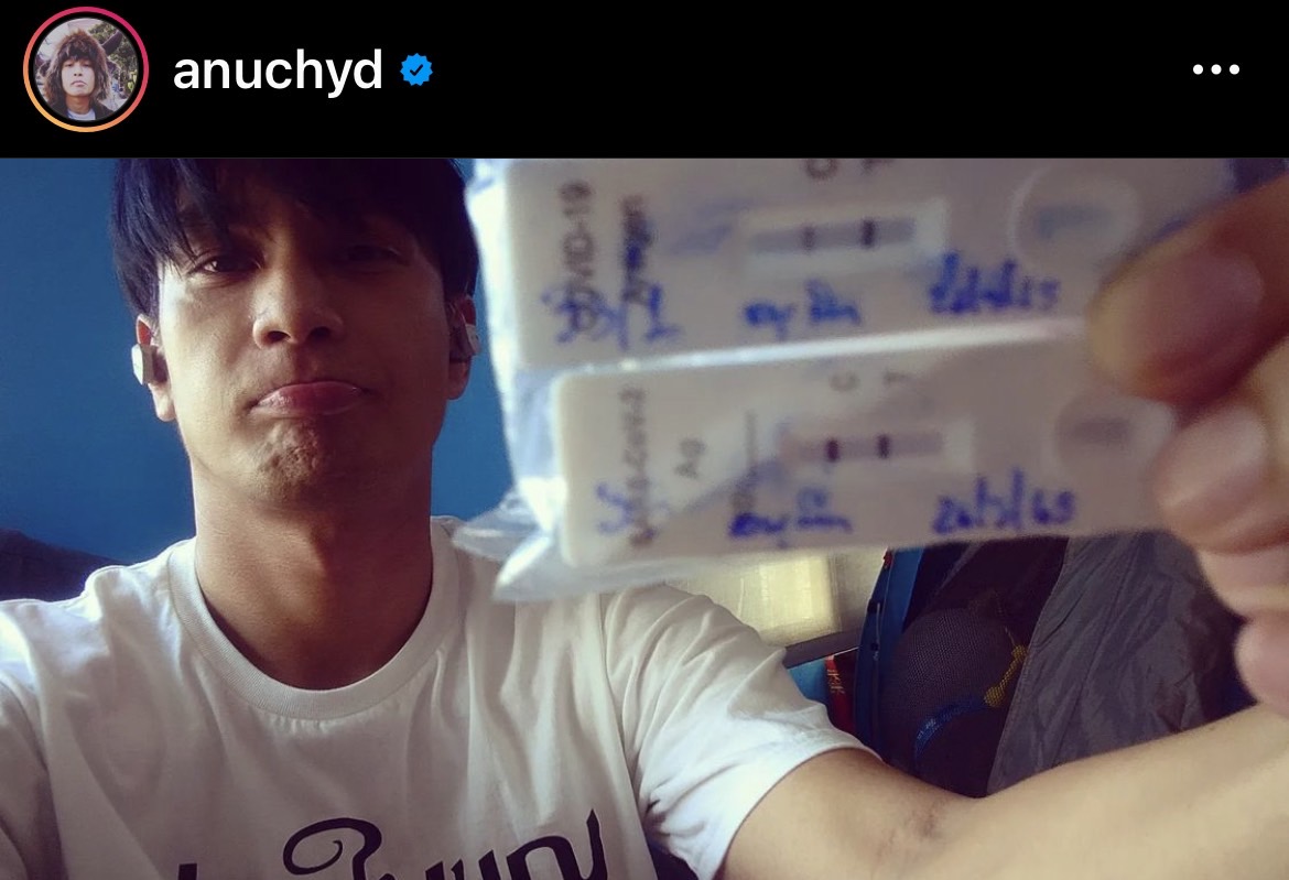 โอ อนุชิต ติดโควิดอีกราย!!  เข้ารับการรักษาตัวอยู่ที่บ้าน 