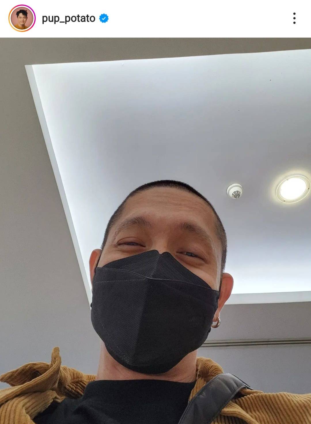 ปั๊บ โปเตโต้ แชร์ประสบการณ์ ก้างติดคอ ต้องล้วงคอลึกมาก ปั๊บ โปเตโต้ แชร์ประสบการณ์ ก้างติดคอ ต้องล้วงคอลึกมาก