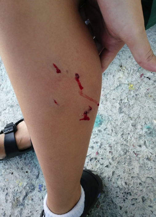 จนได้!บางแก้ววิ่งไล่นร. โดนกัดแล้ว 1 ราย เจ้าของบอกอย่ามองตาหมา