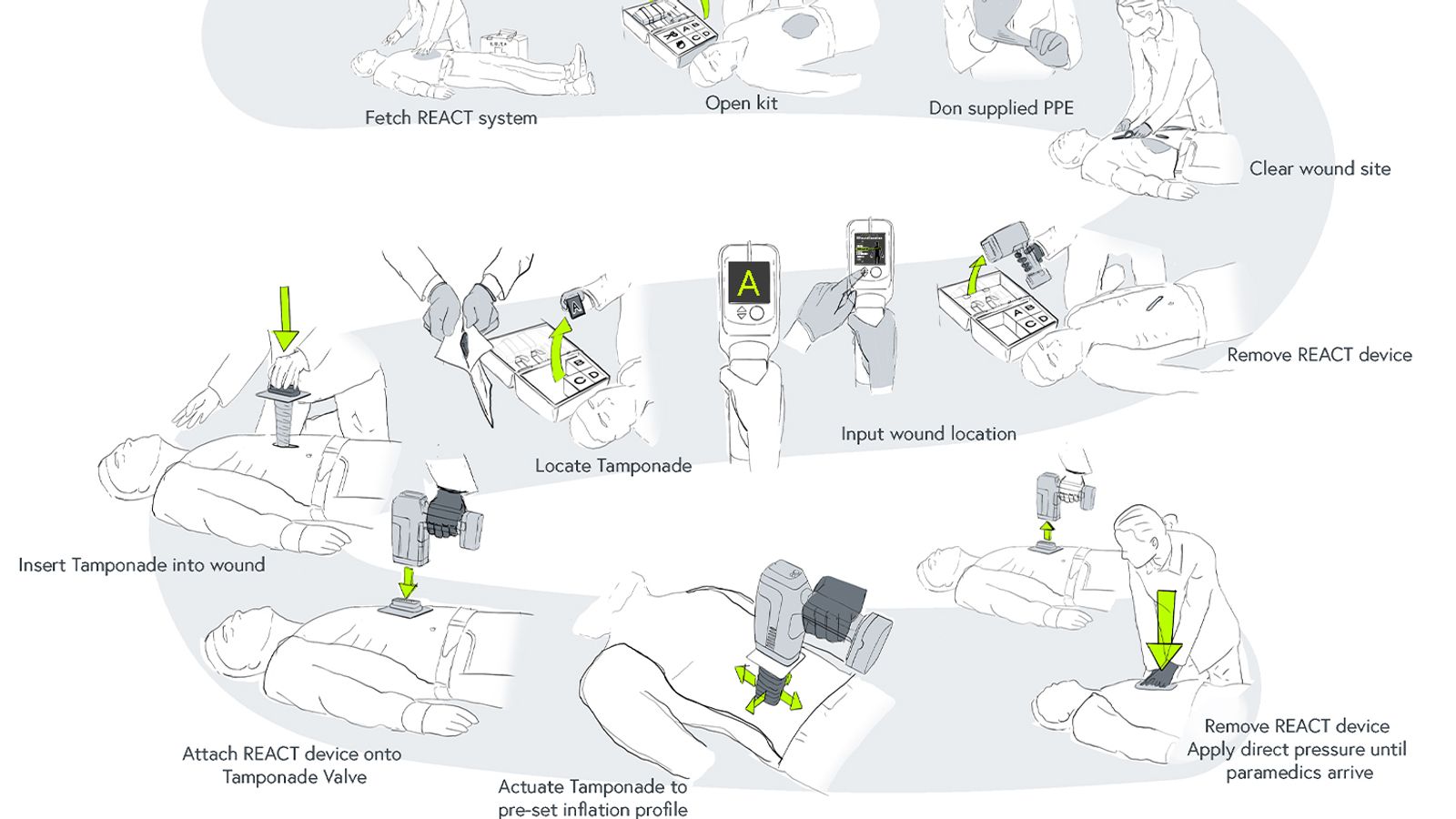 ‘REACT’ อุปกรณ์ห้ามเลือดจากแผลโดนแทง ห้ามได้ใน 30 วินาที! ‘REACT’ อุปกรณ์ห้ามเลือดจากแผลโดนแทง ห้ามได้ใน 30 วินาที!