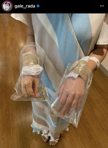 เกล รดา เผยถึงสาเหตุ เอ็นข้อมืออักเสบ เพื่อนๆ แห่เป็นห่วง เกล รดา เผยถึงสาเหตุ เอ็นข้อมืออักเสบ เพื่อนๆ แห่เป็นห่วง