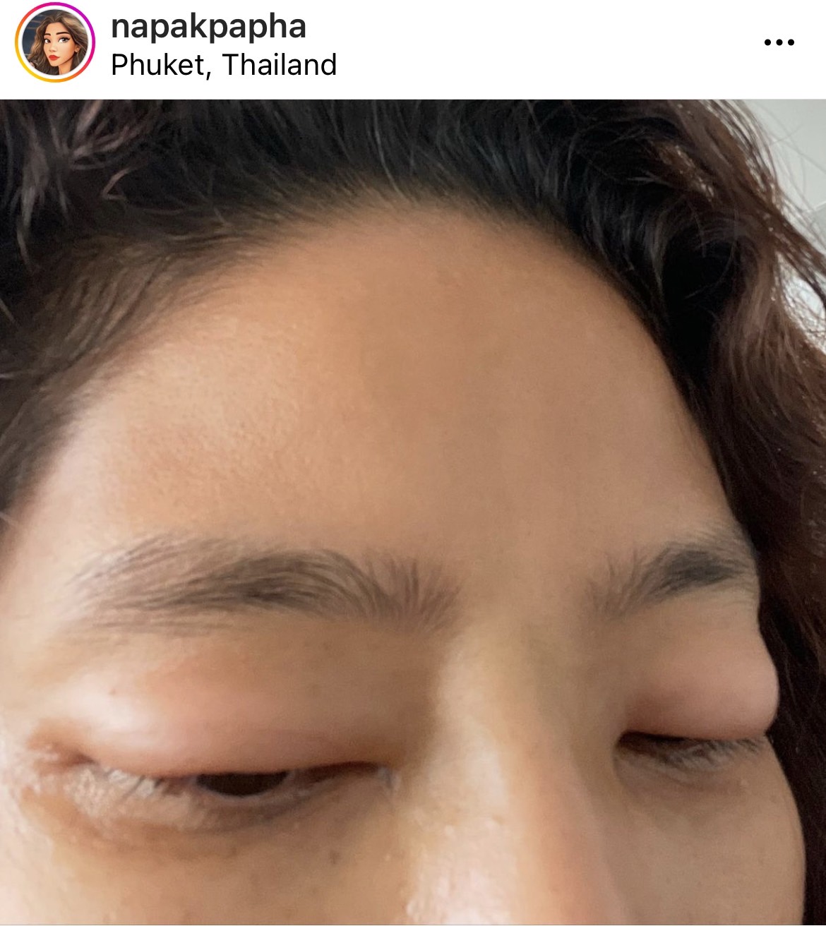 มะหมี่ นภคปภา เกิดอาการแพ้น้ำยาซักผ้ารุนแรง ถึงขั้นหายใจไม่ออก ตาบวม 