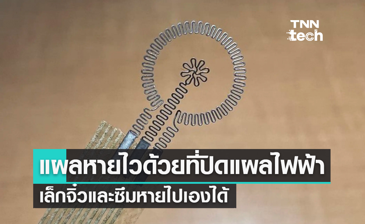 แผลหายไวด้วยที่ปิดแผลไฟฟ้า เล็กจิ๋วและซึมหายไปเองได้
