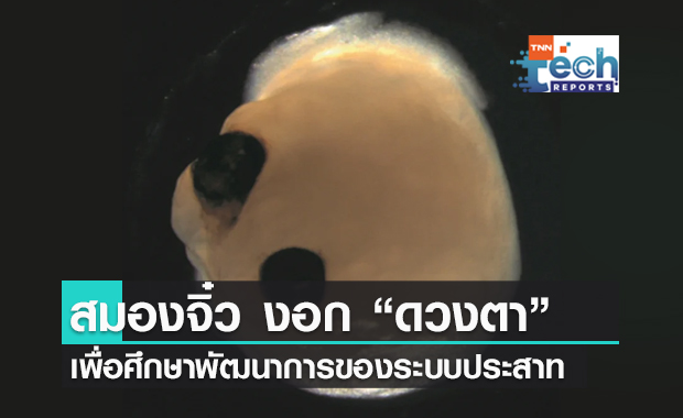 สมองจิ๋ว (Mini brain) จากห้องวิจัยเยอรมนี สามารถงอก "ดวงตา" ออกมาได้แล้ว !!