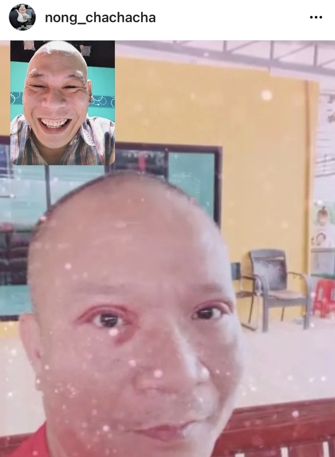 โหน่ง แซว หม่ำ จ๊กมก หล่อจนพระเอกต้องหลบ หลังทำศัลยกรรมครั้งแรก โหน่ง แซว หม่ำ จ๊กมก หล่อจนพระเอกต้องหลบ หลังทำศัลยกรรมครั้งแรก