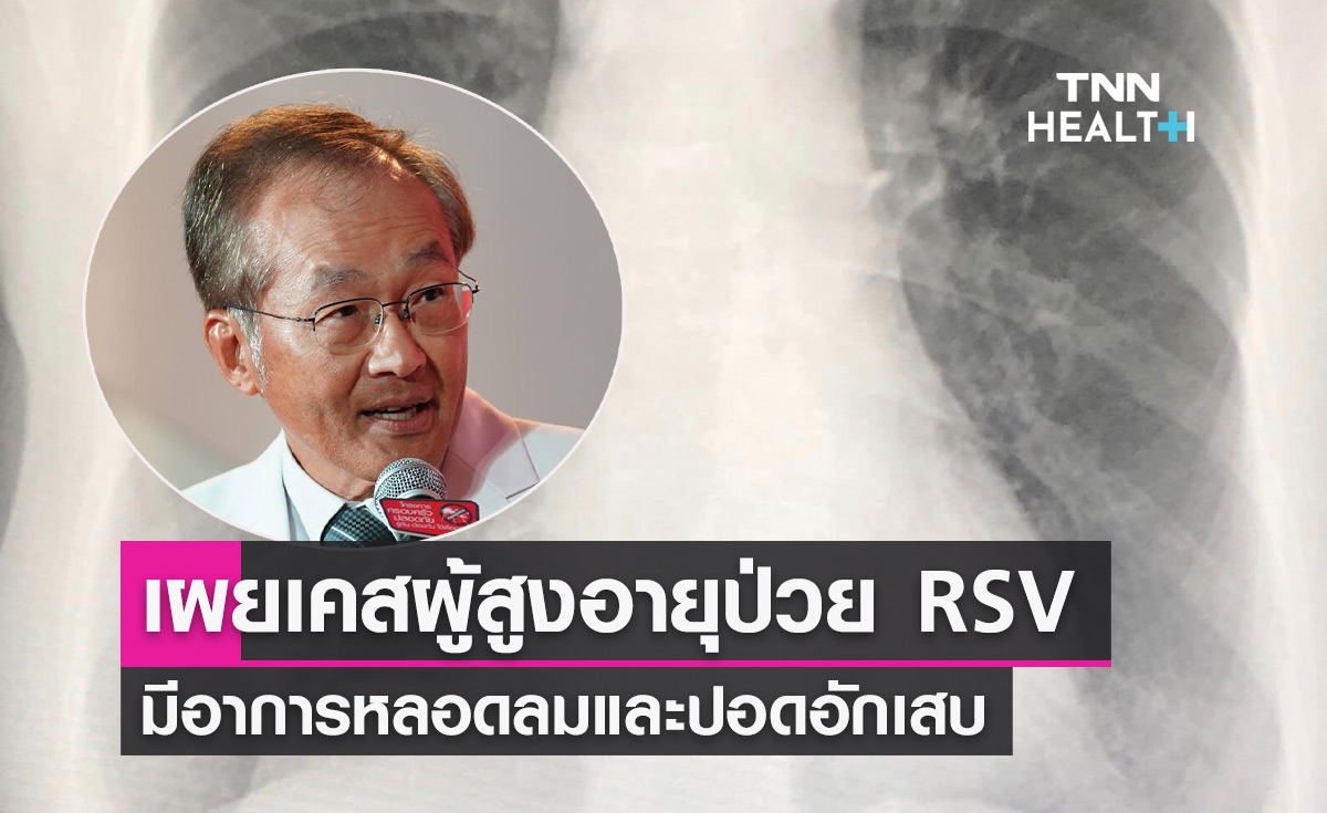 RSV ระบาดหนัก! หมอมนูญ เผยเคสผู้สูงอายุติดเชื้อ ปอดมีฝ้าขาว