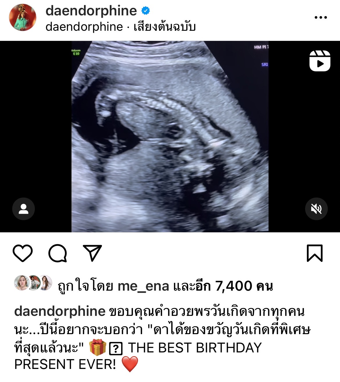 เบบี๋มาแล้ว! ดา เอ็นโดรฟิน ได้ของขวัญวันเกิดที่พิเศษที่สุด เบบี๋มาแล้ว! ดา เอ็นโดรฟิน ได้ของขวัญวันเกิดที่พิเศษที่สุด