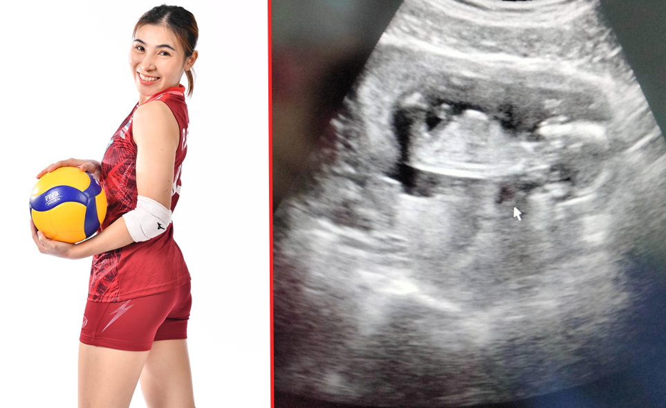 'โสรยา' โพสต์แจ้ง 'ตั้งครรภ์' ทำให้ต้องกลับเชียงรายสละสิทธิ์ลุยวีลีกเกาหลีใต้ 'โสรยา' โพสต์แจ้ง 'ตั้งครรภ์' ทำให้ต้องกลับเชียงรายสละสิทธิ์ลุยวีลีกเกาหลีใต้