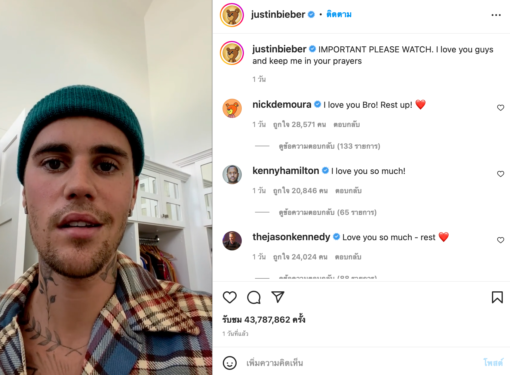 ‘แรมเซย์ ฮันท์’ ทำ 'จัสติน' หน้าอัมพาตครึ่งซีก สำรวจอาการแรกเริ่ม-ป่วยแล้วรักษาหายไหม? ‘แรมเซย์ ฮันท์’ ทำ 'จัสติน' หน้าอัมพาตครึ่งซีก สำรวจอาการแรกเริ่ม-ป่วยแล้วรักษาหายไหม?