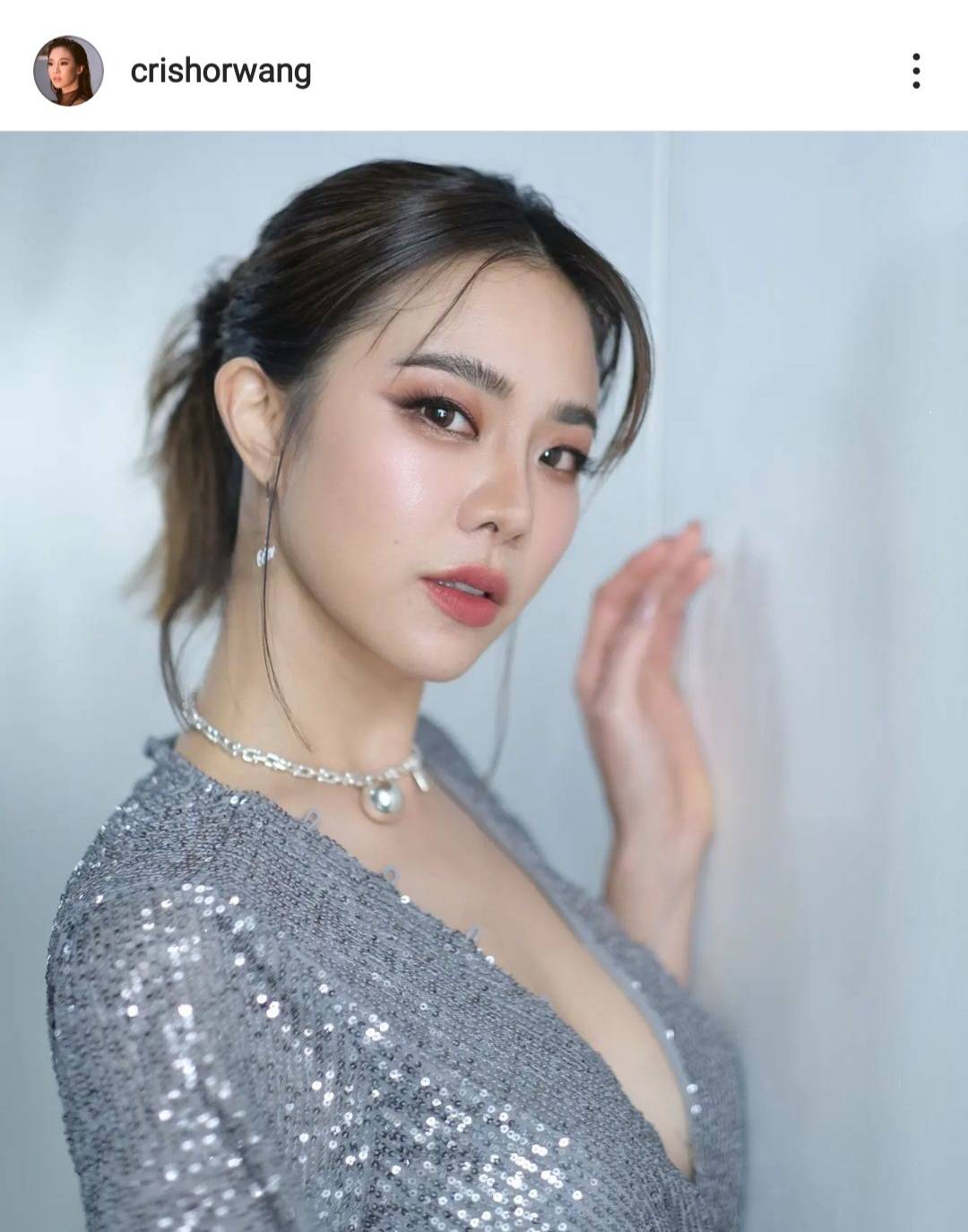 คริส หอวัง เตรียมผ่าตัดหัวเข่า เผย ไม่ต้องห่วง เป็นการผ่าตัดเล็ก คริส หอวัง เตรียมผ่าตัดหัวเข่า เผย ไม่ต้องห่วง เป็นการผ่าตัดเล็ก