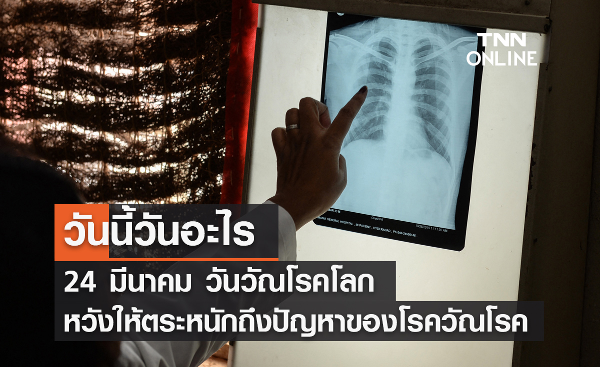 วันนี้วันอะไร วันที่ 24 มีนาคม 2569 ตรงกับ "วันวัณโรคโลก"