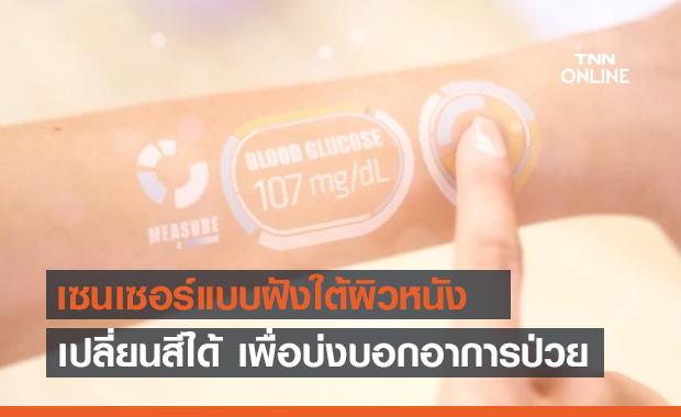 "เซนเซอร์ทองคำ" แบบฝังใต้ผิวหนัง เปลี่ยนสีได้เพื่อบ่งบอกอาการป่วย