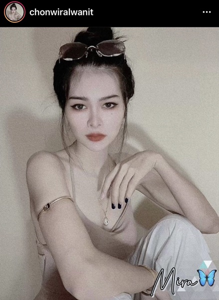 เอ๋ มิรา อัพความสวย ศัลยกรรมจมูก ตา และคาง เอ๋ มิรา อัพความสวย ศัลยกรรมจมูก ตา และคาง