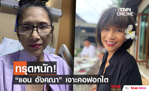 "แอน อังคณา" อาการทรุด ต้องเจาะคอฟอกไต ไม่มีเงินรักษา... 