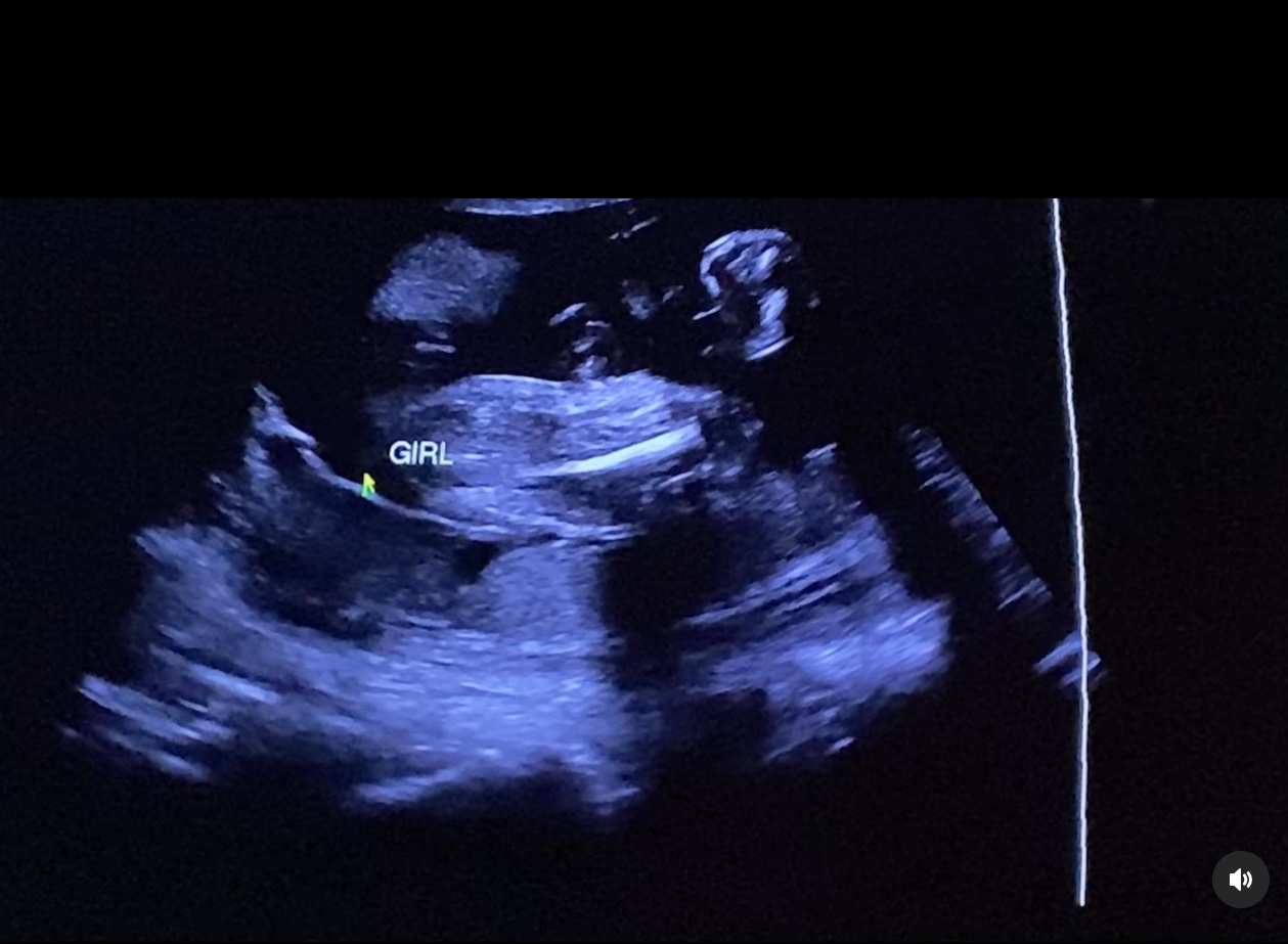 ฟ้า ยงวรี เคลื่อนไหว หลังประกาศข่าวดีตั้งท้อง เปิดหน้าว่าที่คุณพ่อ-ดีกรีไม่ธรรมดา 