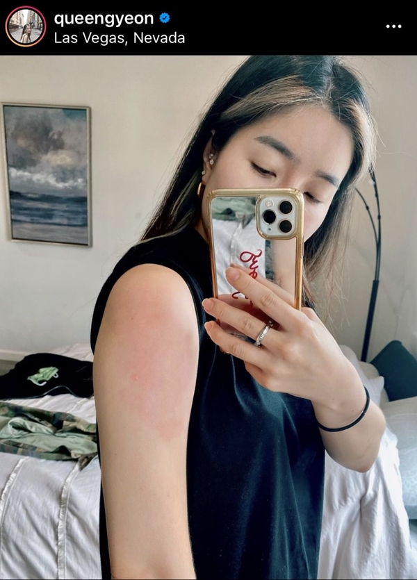 จียอน ฉีดวัคซีนเข็ม 2 เจออาการข้างเคียง จียอน ฉีดวัคซีนเข็ม 2 เจออาการข้างเคียง