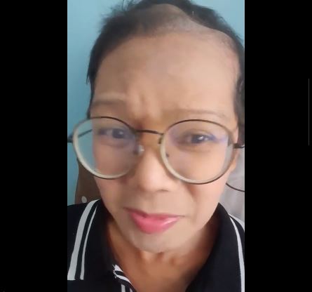  วอนผู้ใหญ่ของานทำ เจน ธัญรดี หลังผ่าตัดเนื้องอกในสมอง ตามองเห็นเลือนราง