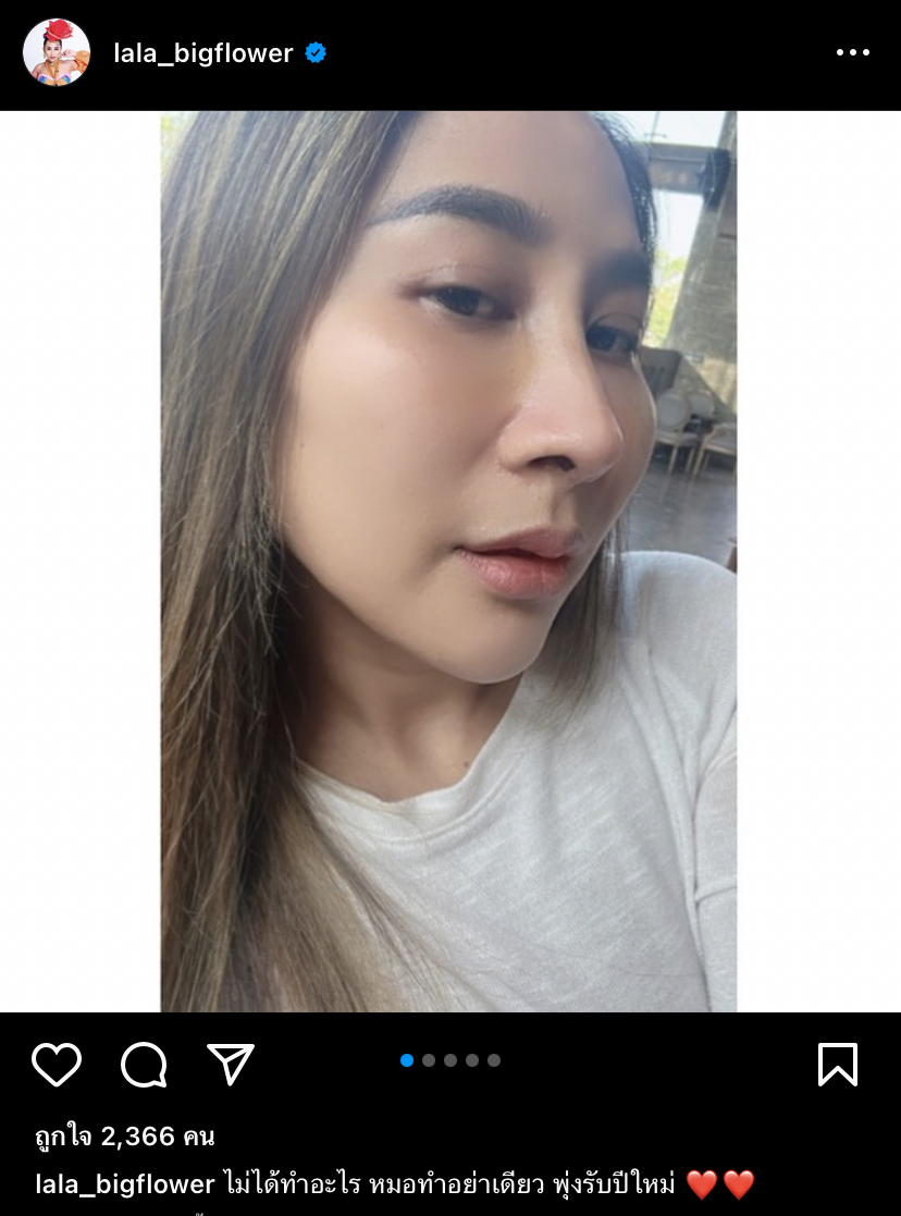 ได้เวลาเปลี่ยน... ลาล่า เสริมจมูกต้อนรับความปัง!