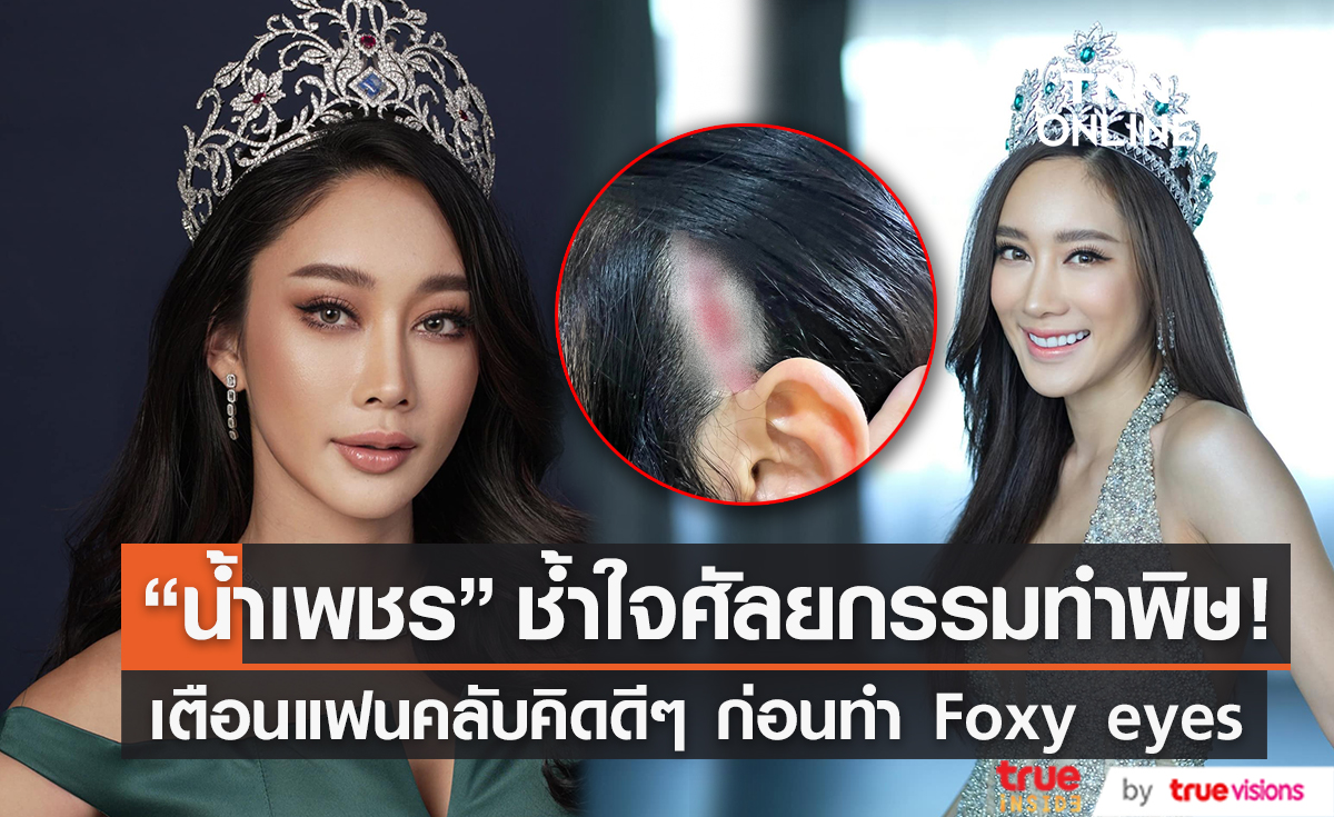 ศัลยกรรมสยอง! "น้ำเพชร ฏีญาร์ภา" หนังศรีษะเปิด หลังขึ้นเขียงทำสวย