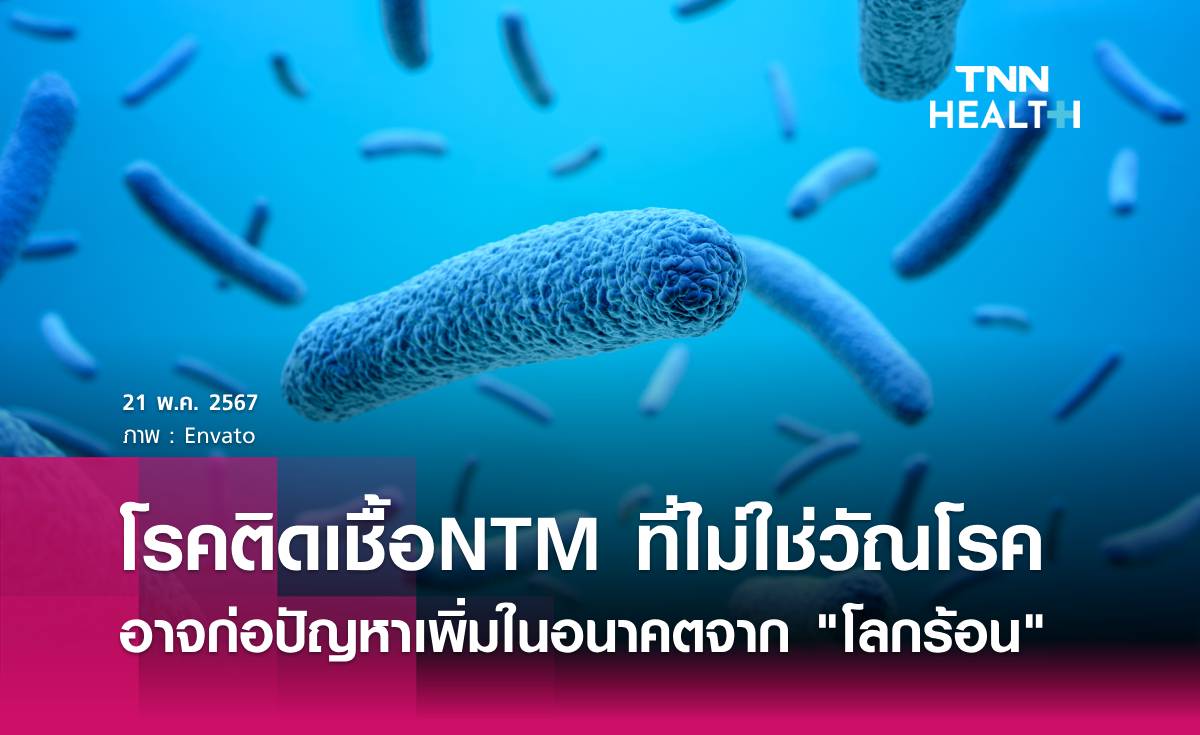 โรคติดเชื้อ NTM อาจก่อปัญหาเพิ่มในอนาคตจาก "โลกร้อน" 