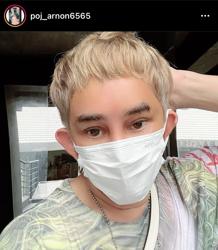 พชร์ อานนท์ หมดเกือบล้านกับการศัลยกรรม ไม่สนคนบูลลี่ พร้อมเผยความคืบหน้าของคดีความ
