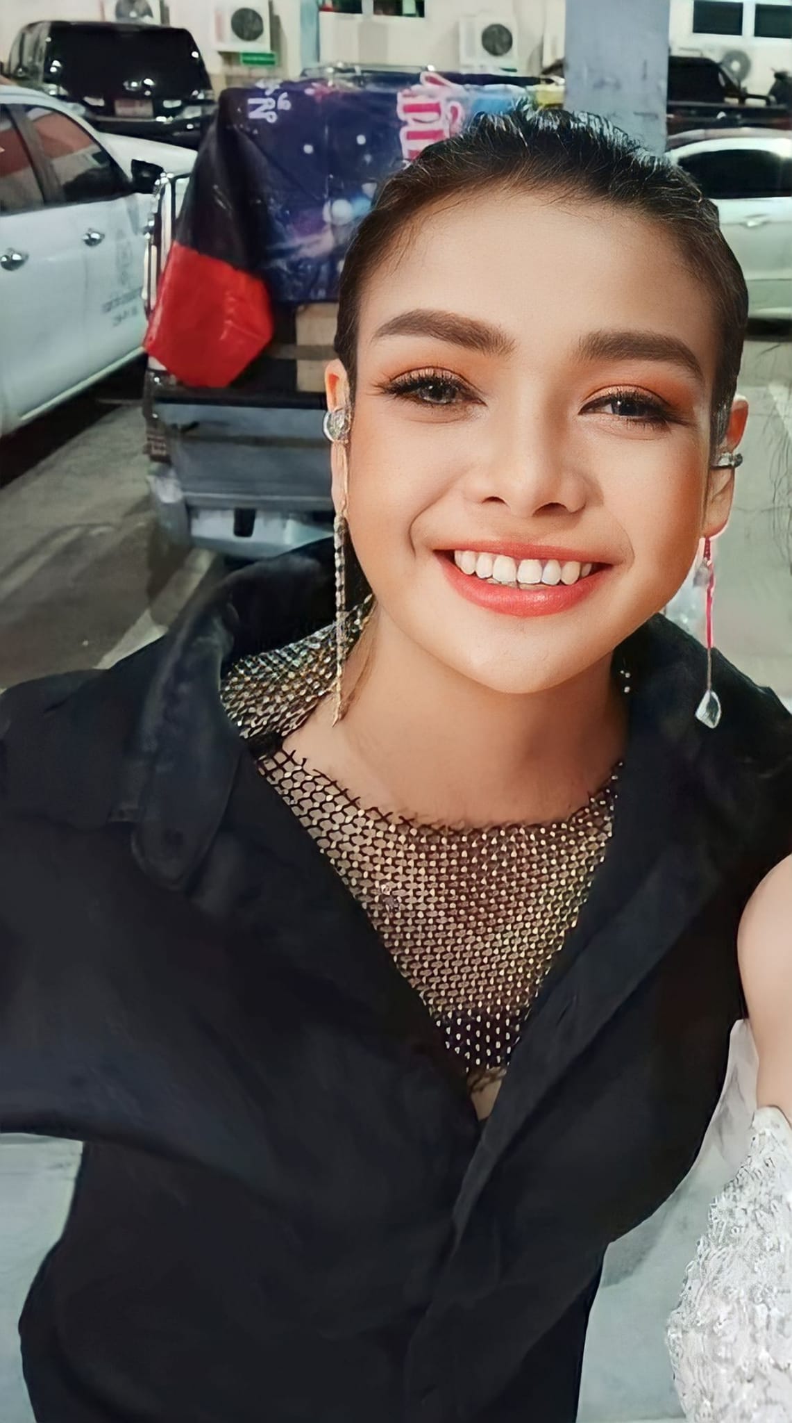 จมูกใหม่สวยมาก ยุ้ย ญาติเยอะ อัปเดตอาการหลังขึ้นเขียงทำศัลยกรรม ทำเอาจำแทบไม่ได้
